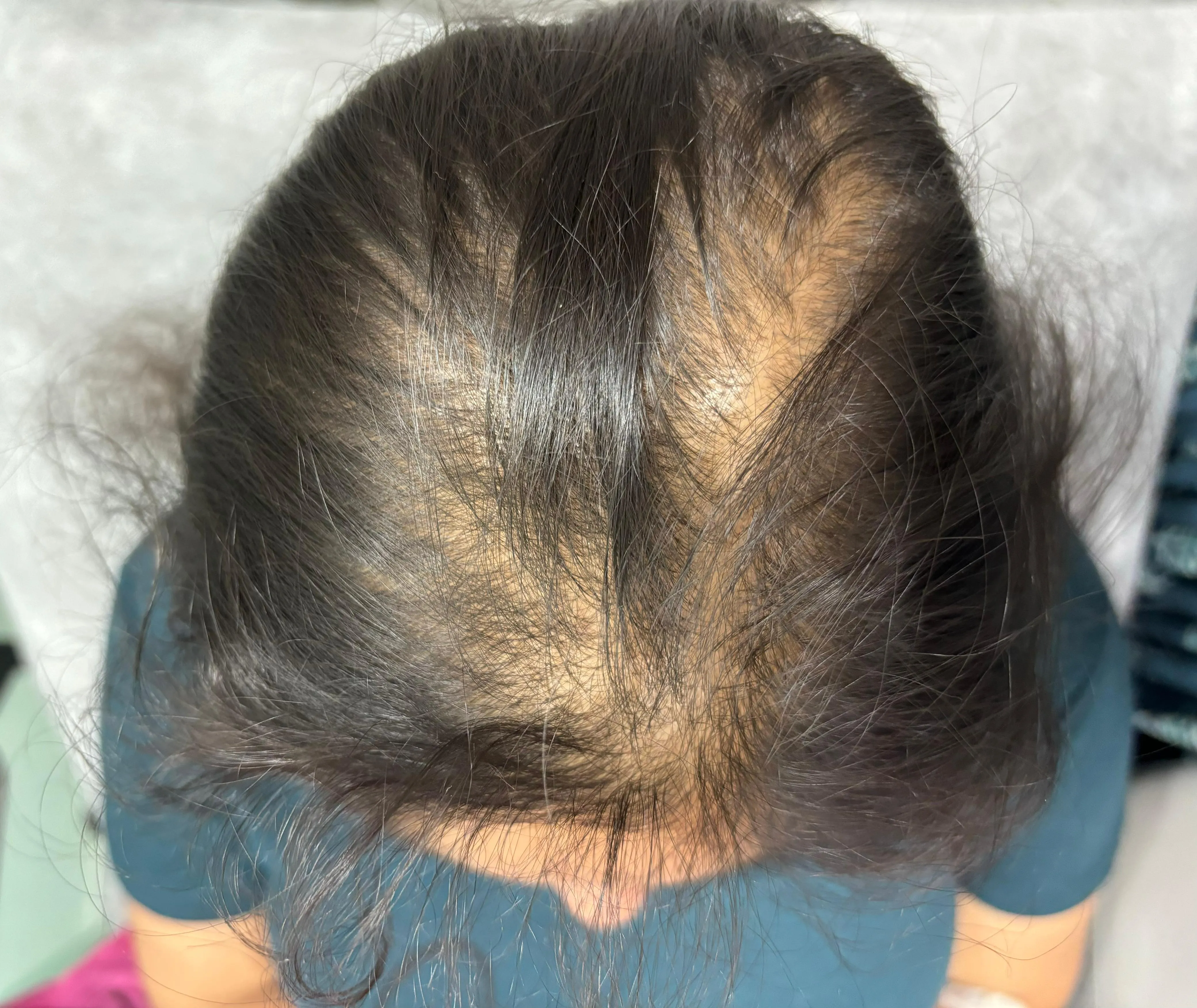 Before treatment case case-01