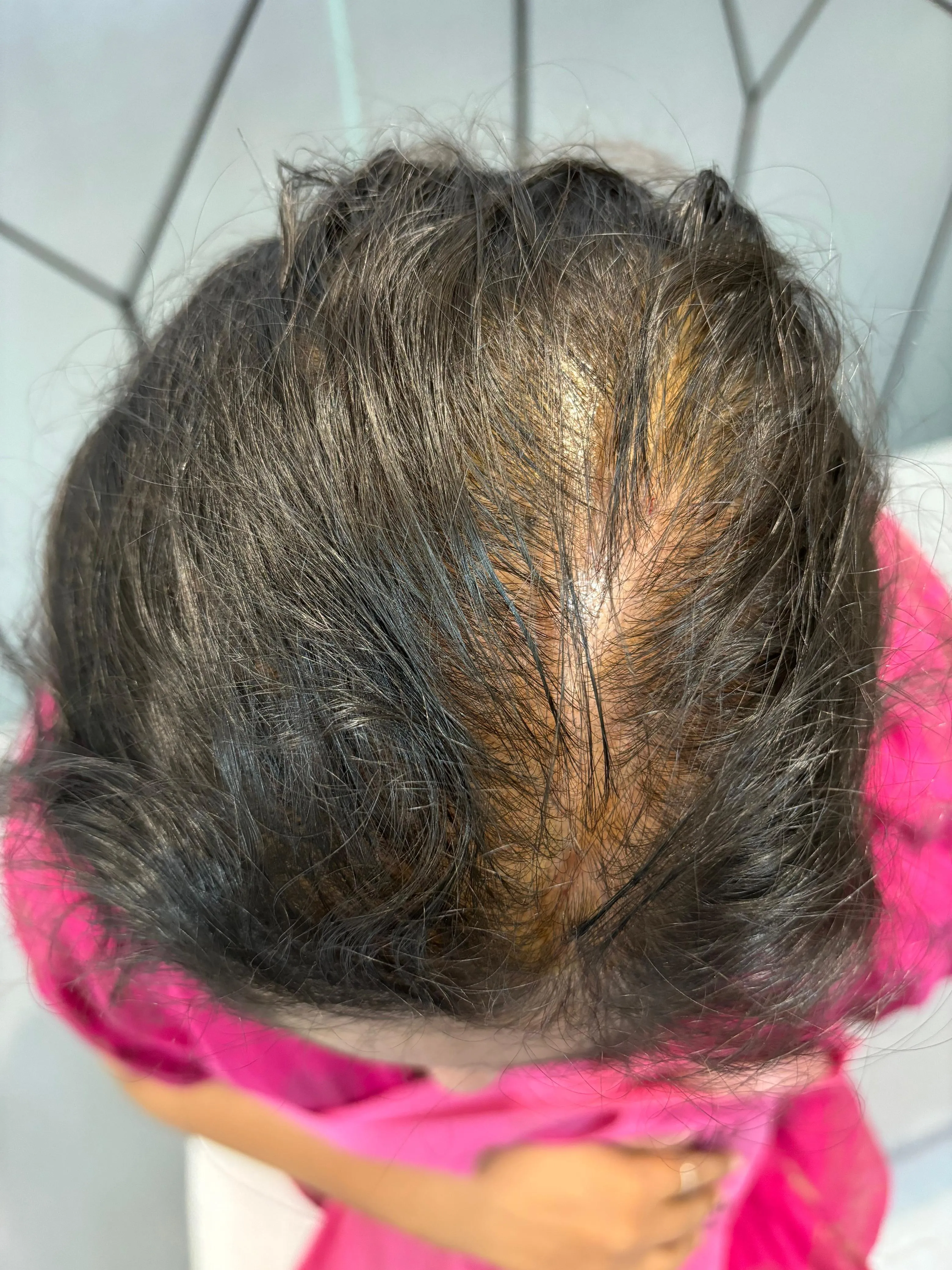 After treatment case case-01