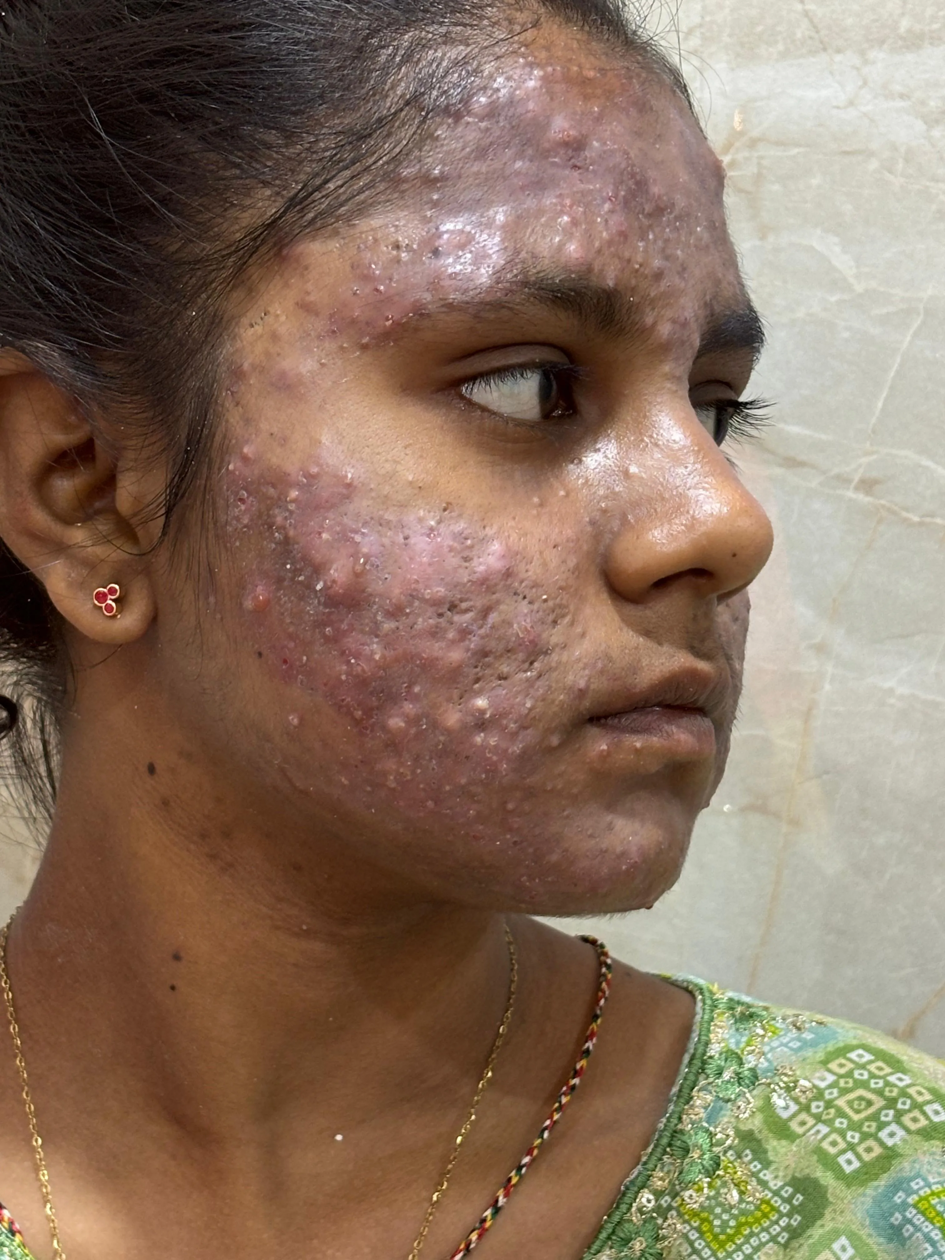 Before treatment case case-02