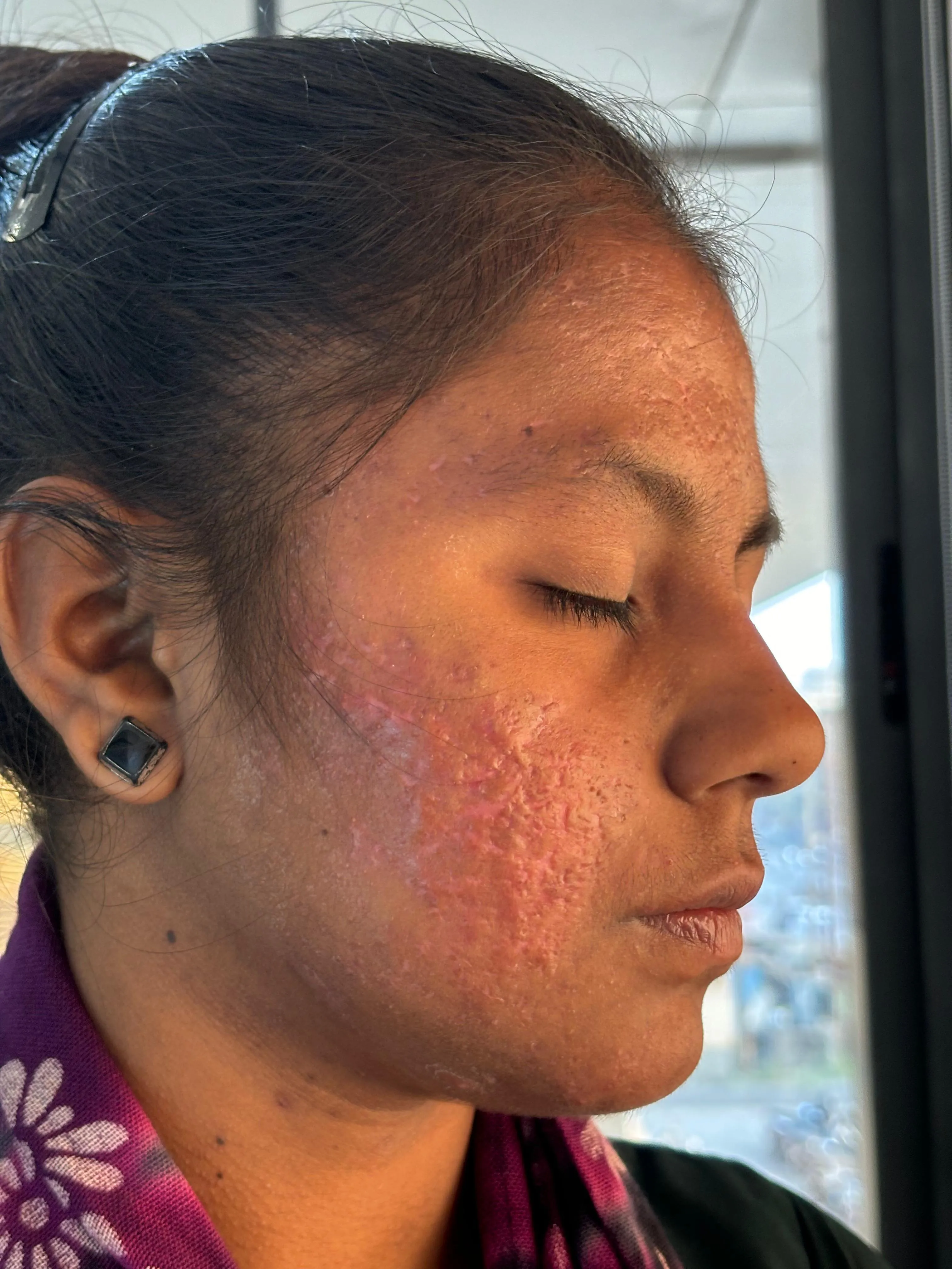 After treatment case case-02