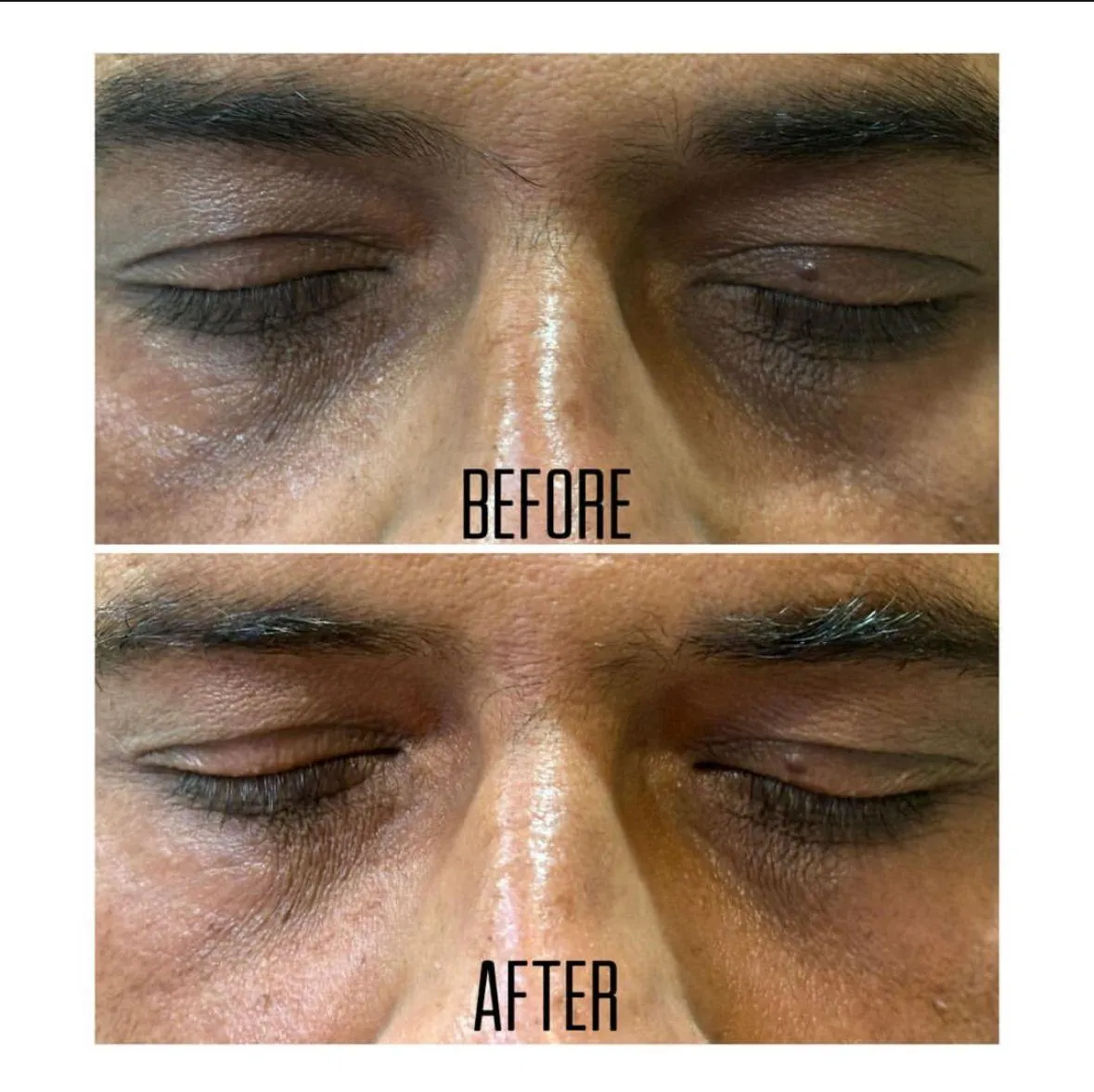 Treatment spotlight case case-03