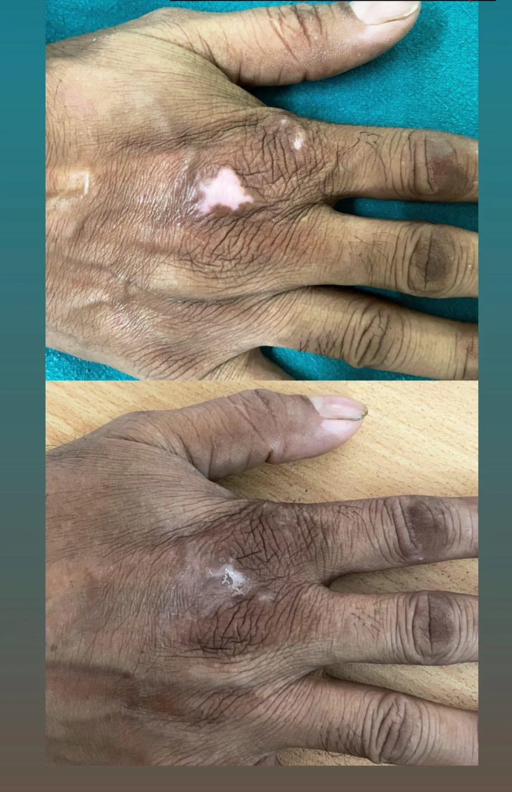 Treatment spotlight case case-04