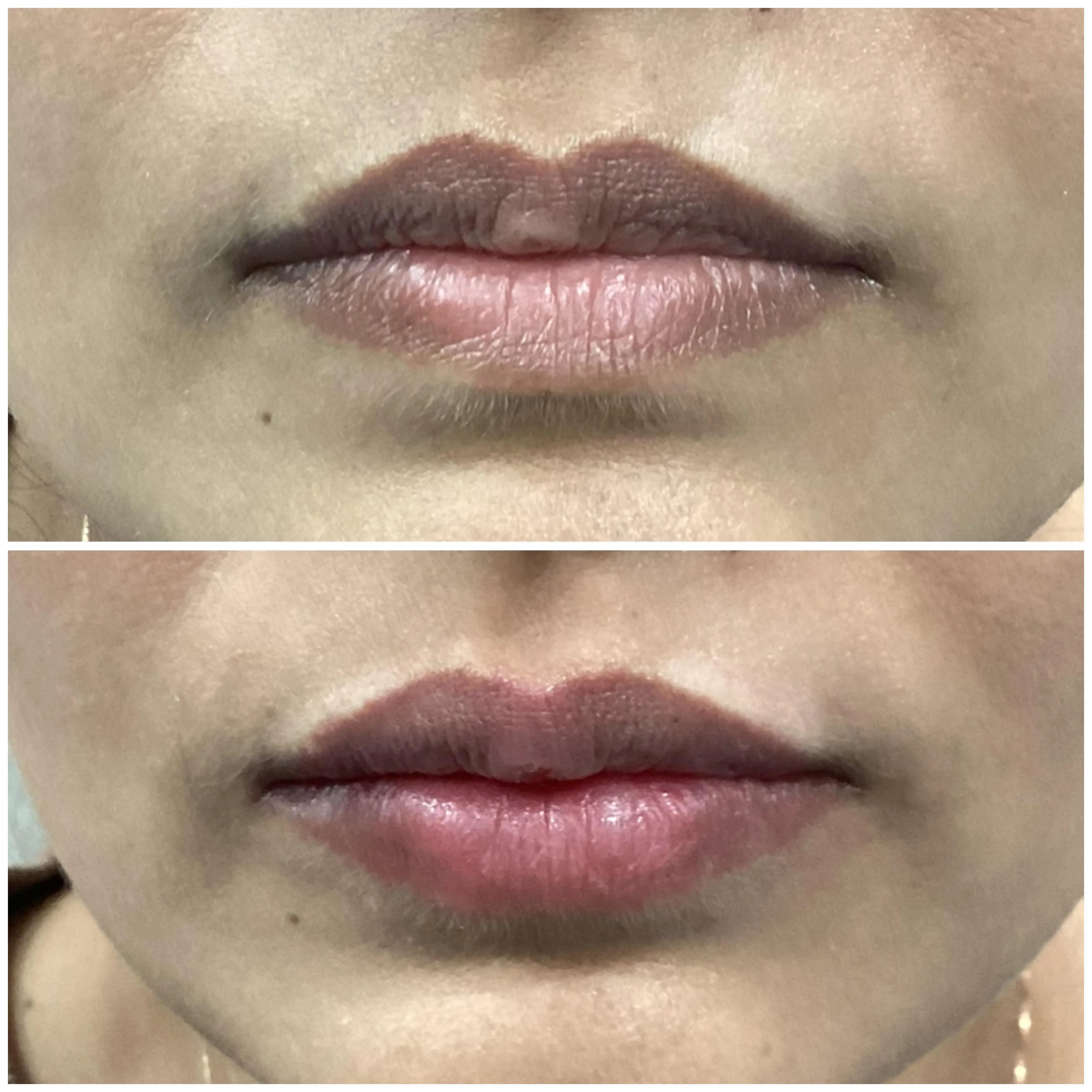 Treatment spotlight case case-05