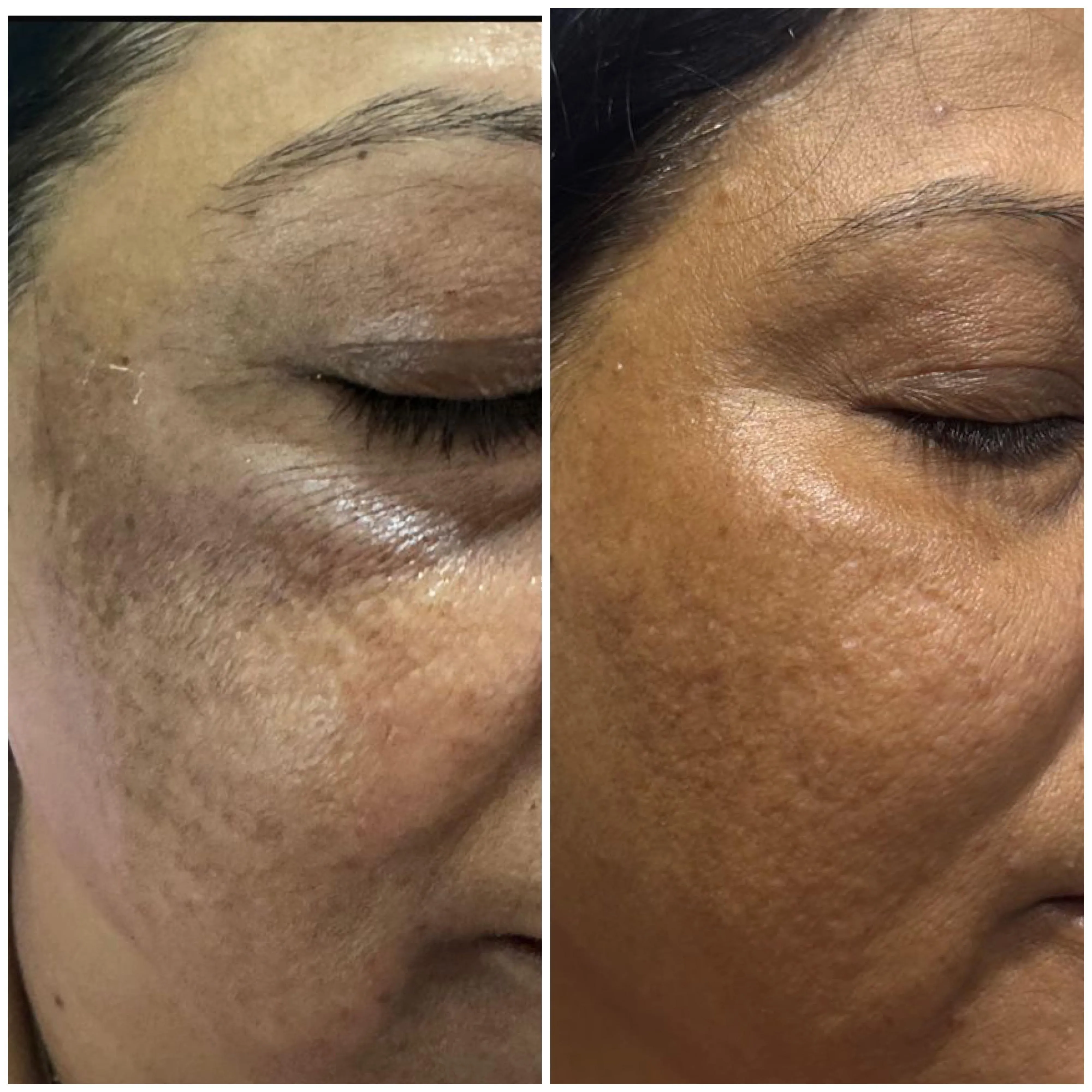 Treatment spotlight case case-06