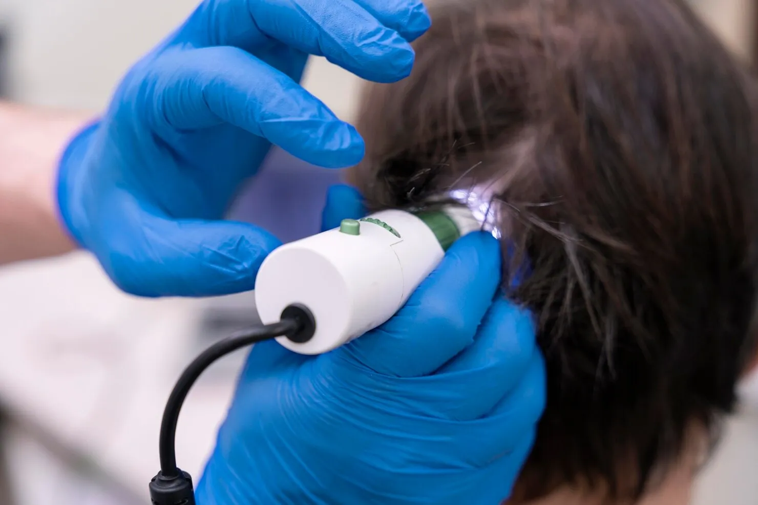 Hair Fall Treatment Vapi