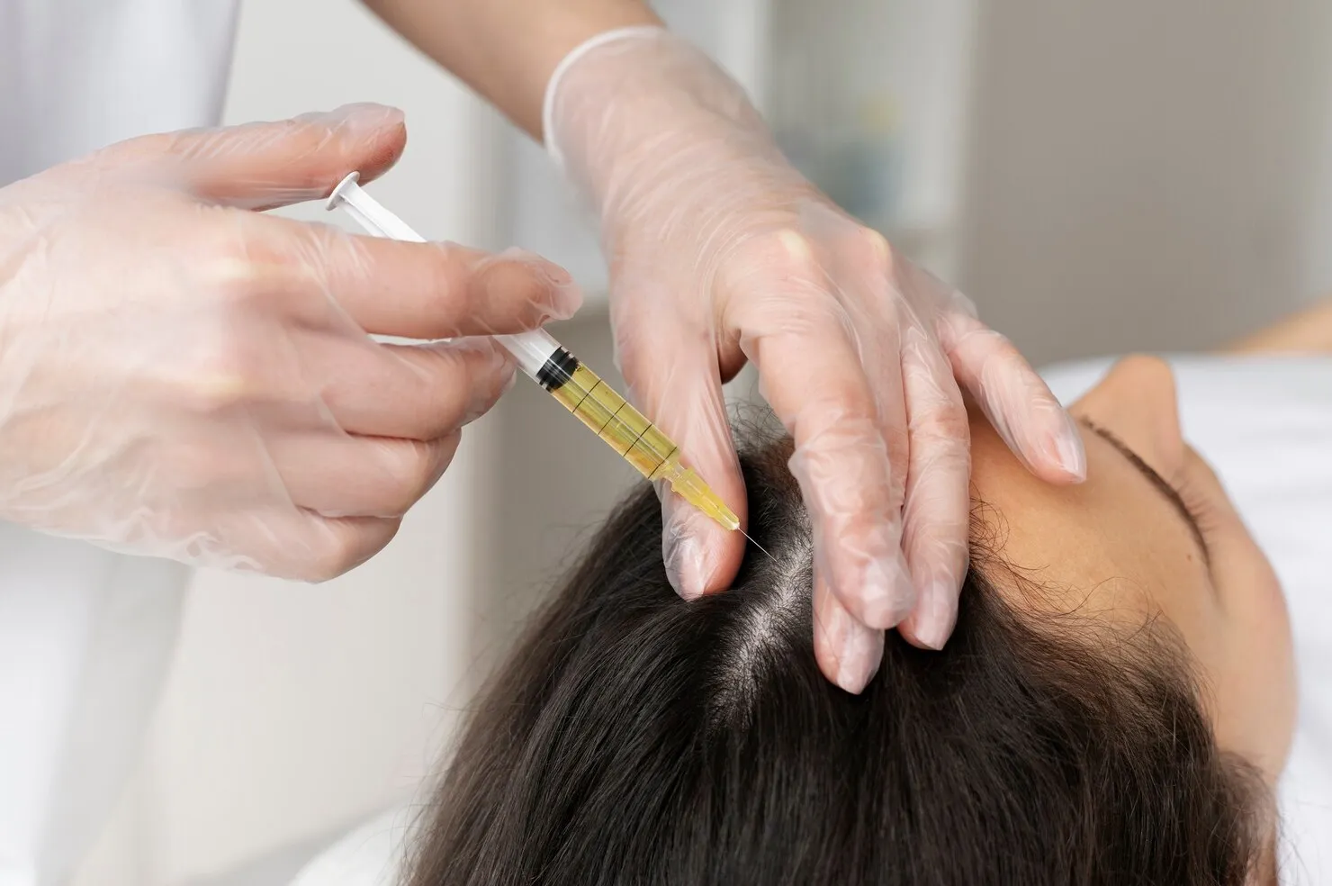 Hair fall PRP treatment and GFC therapies Vapi